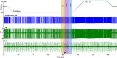 Responses of Neurons in the Medullary Lateral Tegmental Field and Nucleus Tractus Solitarius to Vestibular Stimuli in Conscious Felines